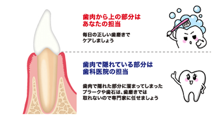 歯肉から上の部分はあなたの担当