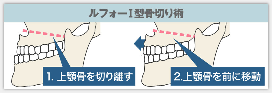 Sラインでの判定方法