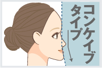 面長・標準・短頭形