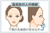 Eラインでの判定方法