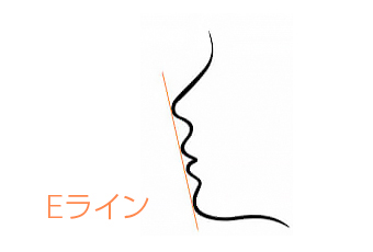 Eライン