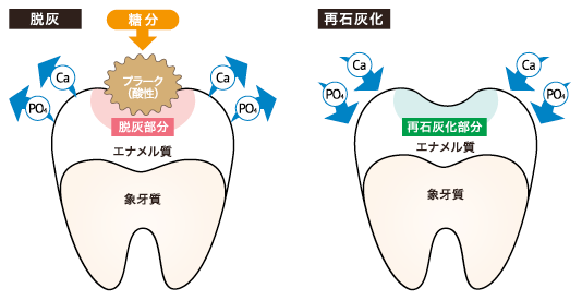 再石灰化