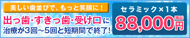 出っ歯・すきっ歯・受け口にナチュラルセラミック！治療が3回～5回で終了！