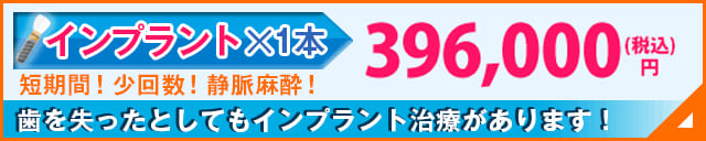 歯を失ったとしてもインプラント治療があります！無痛治療！少回数！静脈麻酔！