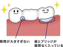 すき間が大きすぎない