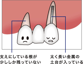 支えている根っこ