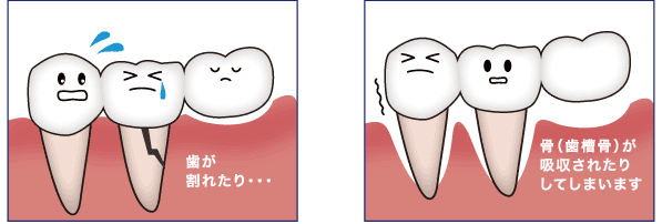 骨が割れたりする