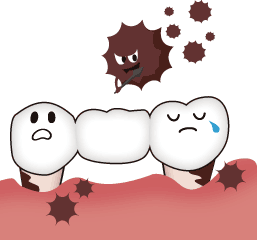 虫歯