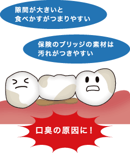 すき間が大きい