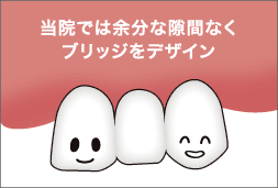 ブリッジをデザイン