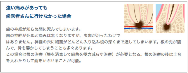 歯医者さんに行けなかった場合