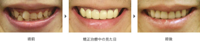 症例