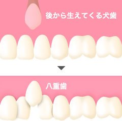 犬歯