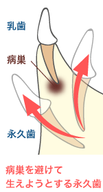 さらに悪くさせてしまう要因