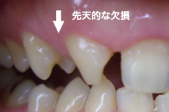 さらに悪くさせてしまう要因