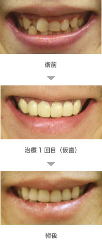 術前・術後