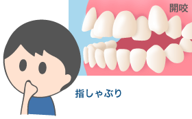 指しゃぶり