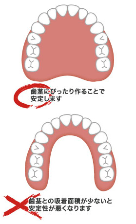 歯茎にぴったり作ることで安定