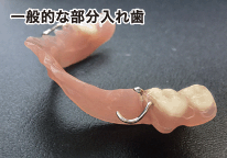 一般的な入れ歯部分