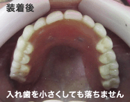 装着後の状態