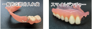 入れ歯