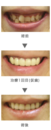 症例写真