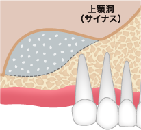 上顎洞粘膜