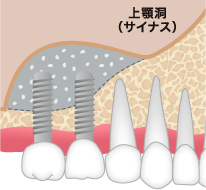安定させるまで