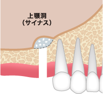 ステップ01