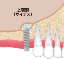 ステップ02