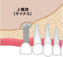 ステップ03