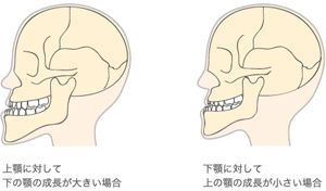 上の顎の発達