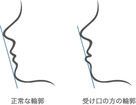 美しいEラインとは