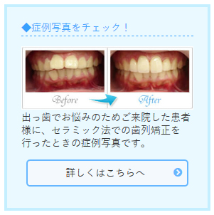 症例写真をチェック
