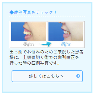 症例写真をチェック