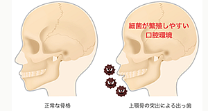 口腔内