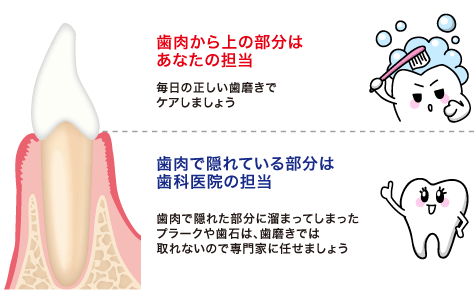 毎日の正しい歯磨きでケアしましょう